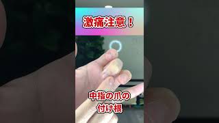 【10秒激痛ツボ押し】指揉むだけで飛蚊症改善する方法！#shorts#飛蚊症#ツボ