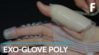 Regain Hand Function With This Incredible Glove