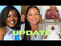 Update on Makhadzi After New Year’s Accident‼️