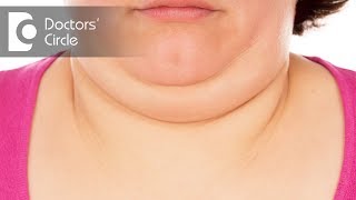 Causes of Double Chin - Dr. K C Nischal
