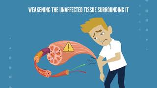 How SWTRT Works. Restore Wellness
