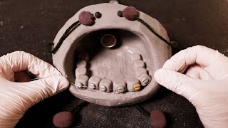 ASMR Little Stone🌚💎Jewel Scaling4 Twinkle Twinkle orthodontic RP|Teeth Scaling|ENG SUB