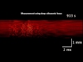 dynamic and quantitative assessment of blood coagulation using optical coherence elastography