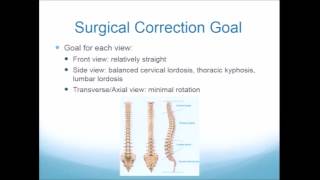 Surgical Correction Different Approach for Different Folks