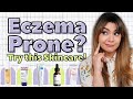 5 HG's for Eczema Flare-Ups! | AD ft Stratia