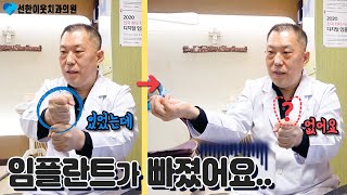 임플란트가 빠진 것 같을 때 어떻게 해야 할까요? 걱정은 No! 임플란트가 빠진 것 같은 모든 상황에 대해 알아두어 대처합시다.