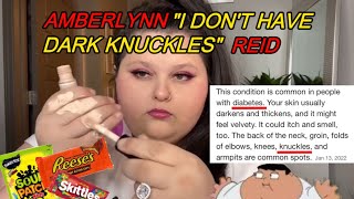 Amberlynn Reid Denying Diabetes Accusations