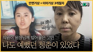 [JP] 원장님, 저도 청춘을 다시 찾고 싶어요..!   |  안면목거상술 이마거상술 편