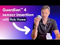 Rob performs a Guardian™ 4 sensor insertion in the arm for best performance and longest wear