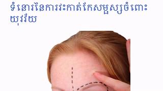 ទំនោរ​វះកាត់​កែសម្ផស្ស​ចំពោះ​យុវវ័យ​