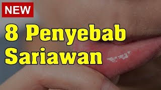 8 Penyebab Sariawan