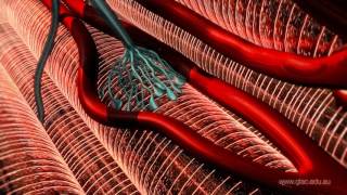 Clostridium tetani and Tetanus