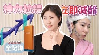 立即見效！MINT Lift 神力拉提埋線術全紀錄，告別鬆弛老化不是夢！｜Nicole汀尼扣