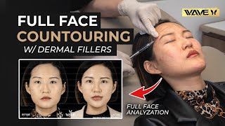 Facial Transformation with Fillers: Adding Facial Contour without Surgery
