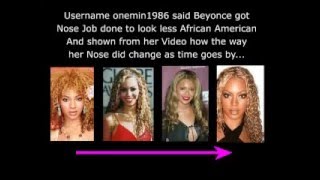 Beyonce plastic surgery - the Truth