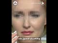 جرائم هزت الكوكب الشابة التي قطعت يدها عن قصد بمنشار كهربائي بغرض الاحتيال