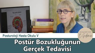 Postür Tedavisi Nasıl Olmalıdır? - Posturoloji Hasta Okulu - V