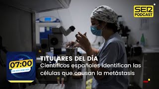 Científicos españoles identifican las células que causan la metástasis