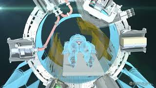 ViewRay MRIdian MR Linac explained (patients)