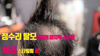 비싼 시술 없이  정수리 탈모 100프로 커버 [ 정수리 탈모 최종 스타일 ] 부천 바버샵 ｜탈모미용실 ｜탈모펌｜부천맨스샵 ｜ HARAM BARBER 💈