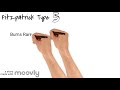 Fitzpatrick Scale - made simple