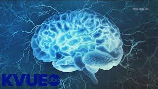 Neuroscientist shares best practices for maintaining brain health | KVUE