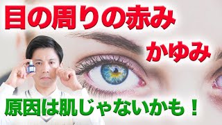 アトピー？肌荒れ？　目の周りの赤みの意外な原因と対策・解消法