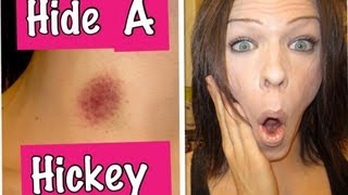 How to Hide a Hickey! or a bruise!