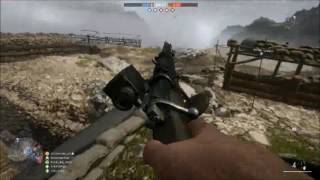 【BF1】バトルフィールド1 バグ(Battlefield1-Bug)　パニック障害