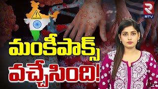 Monkeypox India | మంకీపాక్స్‌ వచ్చేసింది| Mpox Symptoms | Covid | RTV