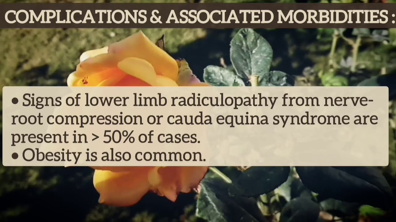 Achondroplasia Radiology Inheritance Symptoms Treatment - YouTube