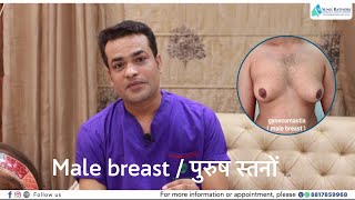 Gynecomastia/ पुरुष स्तनों की वृद्धि / male breast ?..