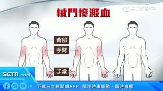 當街砍人喋血！3當鋪員工刀傷送醫｜三立新聞台