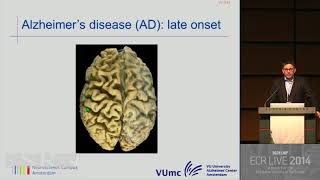 Neuro - Neuroimaging in dementia 3