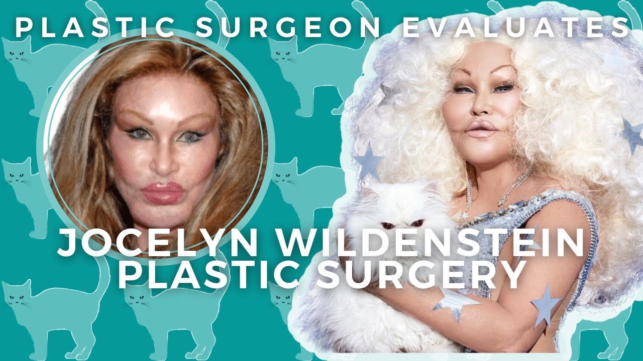 Jocelyn Wildenstein: Plastic Surgery Before And After | Catwoman ...