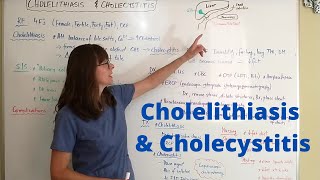 Cholelithiasis \u0026 Cholecystitis