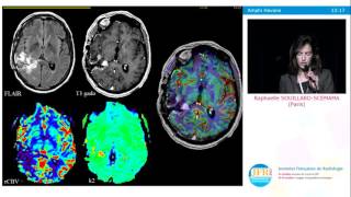 Pathologies vasculaires, inflammatoires, tumorales  le rôle du suivi multiparamétrique