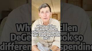 Why does Ellen DeGeneres look so different after spending half a year away from the U.S.?#celebrity