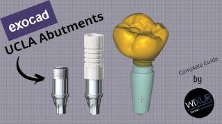 How To Design UCLA Abutments