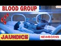 How Blood Group Affects Jaundice in Newborns!