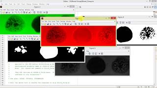 Blood Group Detection Using Matlab Full Project Code