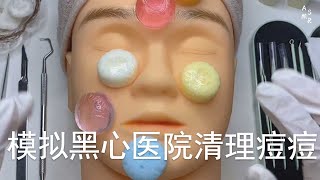 ASMR | 场景模拟黑心医院清理痘痘| 解压助眠【林一睡着辽】