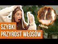 5 SPOSOBÓW NA SZYBKI POROST WŁOSÓW 🔥