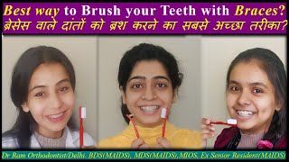 BEST way to BRUSH with BRACES!! ब्रेसेस वाले दांतों को ब्रश करने का सबसे अच्छा तरीका? @ Dr Ram