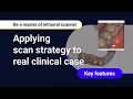 Applying scan strategy to real clinical case