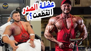 لحظة اصابة البطل ريان كراولي وتمزق عضلة الصدر + شرح الاصابة والعملية الجراحية ryan crowley injuiry