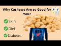 Are Cashews Good For You? Are Cashews Healthy? Keto Health 101