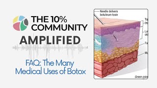 FAQ: Medical Uses of Botox