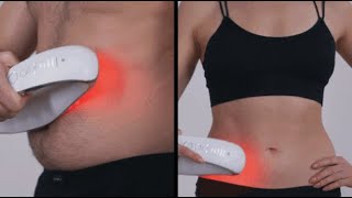 FAT IRON : IRON-OFF STUBBORN FAT & STRETCH MARKS WITH THIS DEVICE | Gizmo-Hub.com