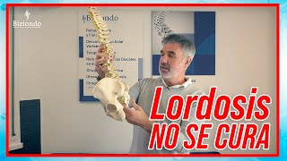 👉 LORDOSIS | ¿Qué es? ¿Es grave? ¿Tiene cura? Abre el vídeo y descúbrelo